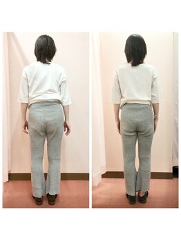 寝屋川鍼灸整骨院/産後骨盤矯正