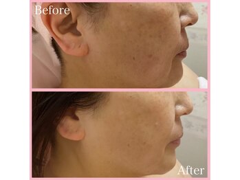 クイーン 熱海店(Queen)