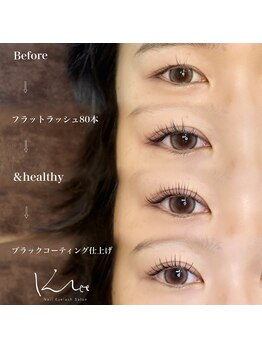 クレー(Klee)/アンドヘルシー