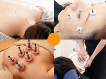 鍼・カッピング・マッサージ豊富なメニューでお悩み解消