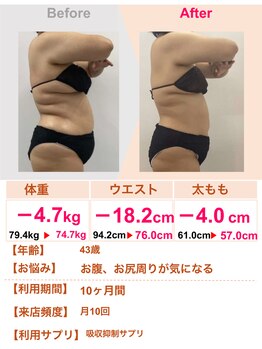 スリムステーション 高槻駅前(Slim Station)/お腹のたるみがスッキリ！