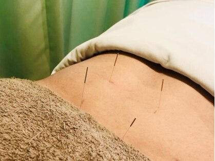 くわえ鍼灸整骨院の写真