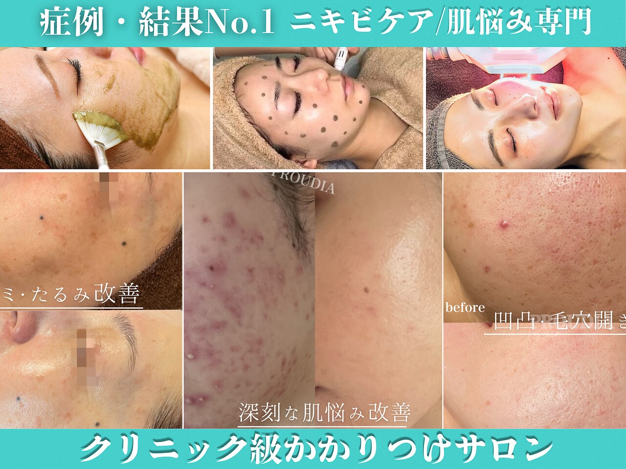 プラウディア(PROUDIA)｜ホットペッパービューティー