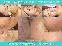 プラウディア(PROUDIA)