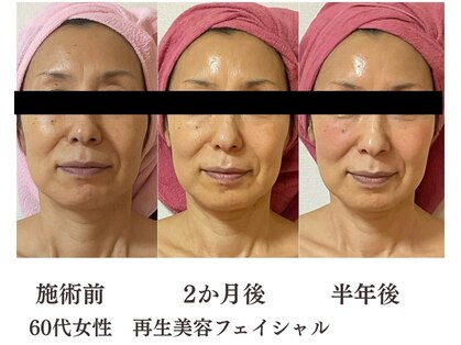 リボーン 東久留米の写真