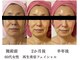リボーン 東久留米の写真