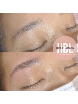 アロー(Allo!)/ハリウッドブロウリフト