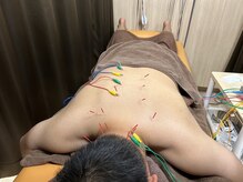 このは接骨院/首～背中のハリに鍼！