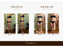 ハンズ鍼灸接骨院小牧院 美容整体ハンズ(美容整体hands)/エステ before after