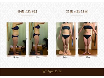 ハンズ鍼灸接骨院小牧院 美容整体ハンズ(美容整体hands)/エステ before after