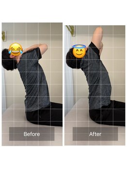 ナオル整体 恵比寿院(NAORU整体)/恵比寿/整体事例