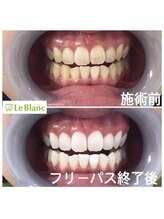 ルブラン 奈良店(Le Blanc)/白い歯で好印象♪