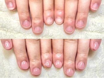 グラシナ なんば店/深爪/自爪育成/フィルイン