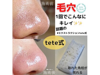 ヒメミ(Himemi)の写真