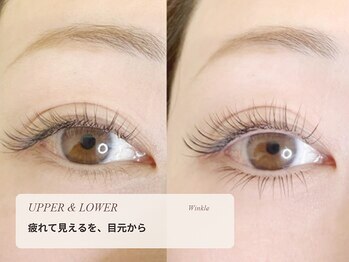 アイラッシュサロン ウインクル(Eyelash Salon Winkle)の写真/【30代からの大人まつげ】「疲れて見える」を上下マツエク・まつげパーマで明るい目元へ【Winkle伊勢崎】