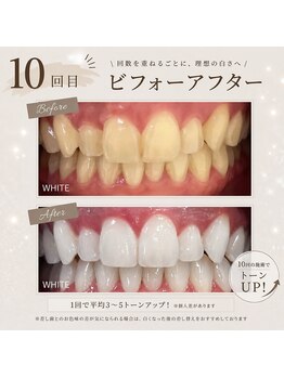 ホワイト 上乃木南店(WHITE)/10回目ビフォーアフター