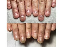 イズム(Izm)/上before/下after 約3ヶ月時点