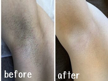 ケースタイル(k.style)/お客様before after