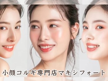 マキシフォート 名駅店(Maxifort)の写真/周りから「痩せた？」って聞かれる、あの嬉しい感覚☆オールハンドの小顔コルギ◎