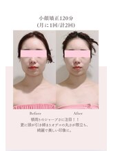 トゥインクル 麻布(twinkle)/南麻布/シンメトリー小顔矯正