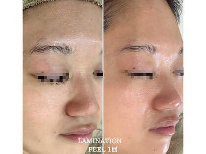 ルリエベル(Relier Belle)の写真