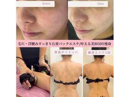 ラ レーヌ(La-leine)の写真