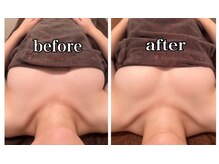 シェノン(CHAINON)/オールハンド美バスト