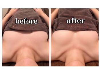 シェノン(CHAINON)/オールハンド美バスト