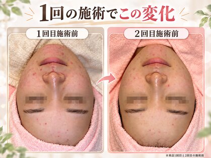 ヌヴェラスキン 梅田店(NUVELA SKIN)の写真