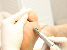 ルーム ノヘア(Room nohea)/ドイツ式足裏フットケア　【5】