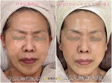 ピエルクララ(Piel clara)