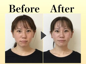 スマイル 神戸魚崎店(SMILE)/~Before、After~