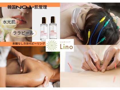 リノ(lino)の写真