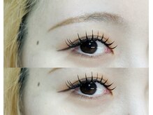 ビュー(V.I.E.W)/BINDLOCK100束