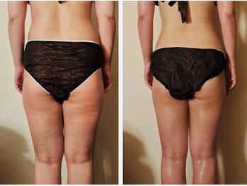 マナ(mana)/30代下半身ダイエット