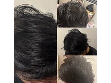 ポノピピ(ponopipi)の雰囲気（頭皮ケア育毛促進コース2回目）