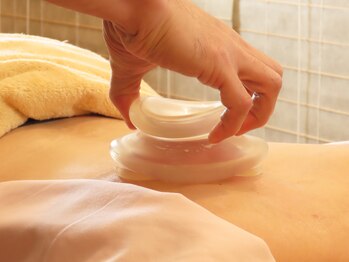 初田鍼院 恵比寿/ファンクショナルカッピング