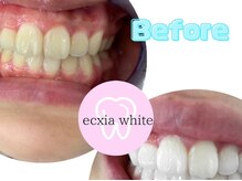 エクシアホワイト 宮崎末広店/