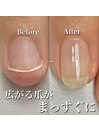 広がる爪も整います！