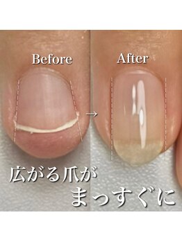 リリー/広がる爪も整います！