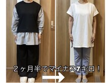 さっぽろ心灯はり・きゅう院/現在ダイエット頑張っている方