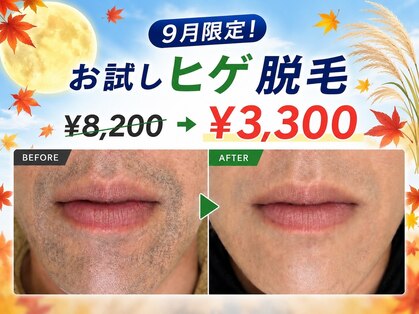 ビビの写真