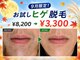 ビビの写真