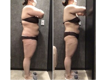 フローボディ(flow BODY)/山口のダイエットはflow BODY