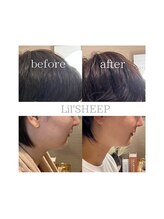 リルシープ(LIL'SHEEP)/眠れる小顔コルギ1回施術