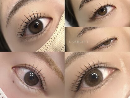 ベルミー(BellMe)の写真