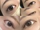 ベルミー(BellMe)の写真