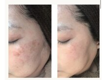 ルポザメンテナンス 長岡店(RUPO THE MAINTENANCE)/シミ除去ホワイトラボ