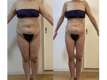 メルシー サロン(Merci Salon)の雰囲気(温めてぷよぷよ贅肉を撃退!5ヶ月で-19.3kg!体脂肪率-13.8%減!)