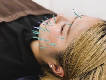 つむぎ鍼灸整骨院の写真/国家資格者在籍★肩こりや腰痛緩和など身体の不調を根本的に改善◎コースクーポン多数ご用意♪